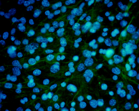 Las células de la piel bajo microscopio photo