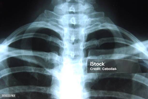 Radiografía De Tórax Foto de stock y más banco de imágenes de Ajuste quiropráctico - Ajuste quiropráctico, Anatomía, Asistencia sanitaria y medicina