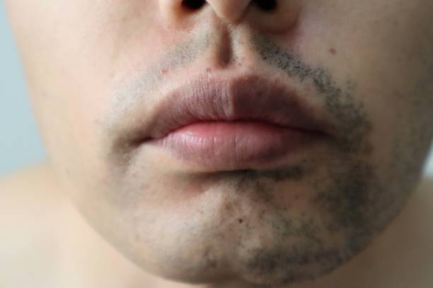 istock Japanese man with only half his beard shaved 1722250778