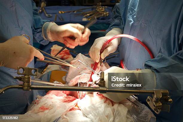 Surgeon Performing Vascular Surgery Stock Photo - Download Image Now - Critical Care, Expertise, Healthcare And Medicine