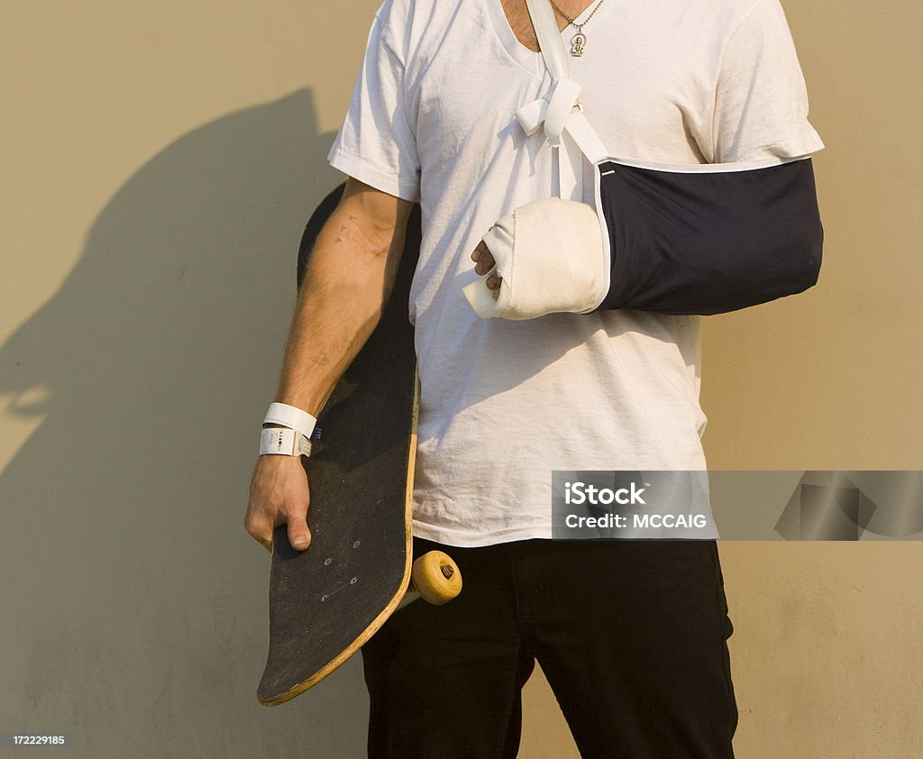 BRAZO FRACTURADO - Foto de stock de Brazo fracturado libre de derechos