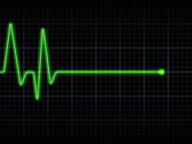 istock A green line from an Electrocardiogram ECG / EKG 172232395