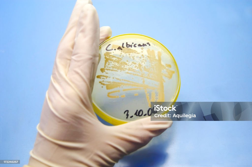 Gélose microorganismes cultivés sur plaque - Photo de Candidose buccale - Infection fongique libre de droits