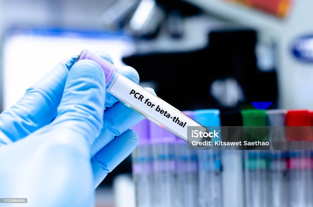 Blood Unit Sampling Blood Sampling Tube Stock Photo - Download Image Now - Anatomy, Anemia ...