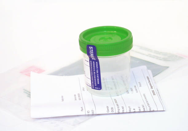 Urine Lab Test Set stock photo