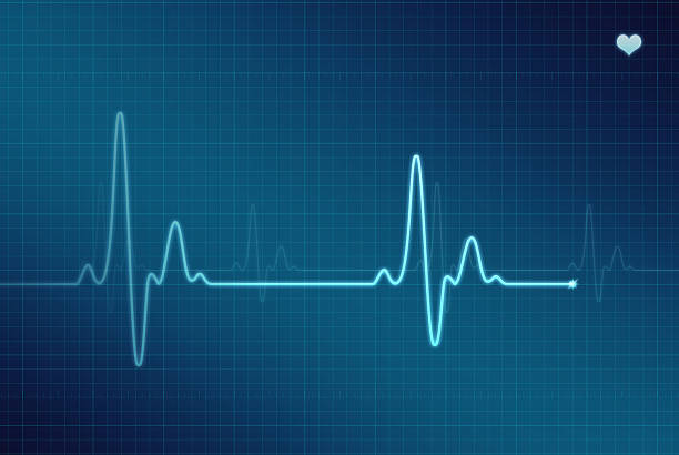 EKG - Electrocardiogram (XXL) Illustration of an electrocardiogram (ECG / EKG). heartbeat stock pictures, royalty-free photos & images