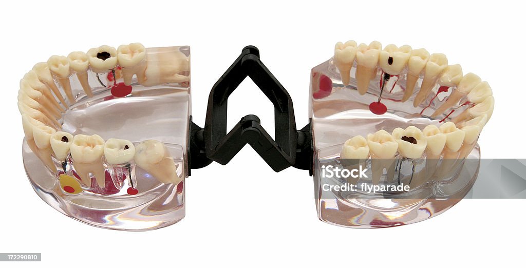 Estudio modelo de dientes - Foto de stock de Abierto libre de derechos