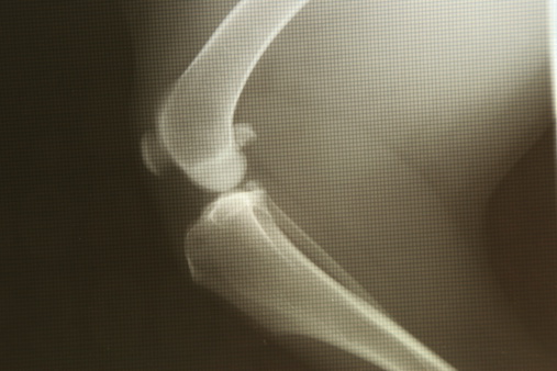 Xray of a canine knee with grid texture