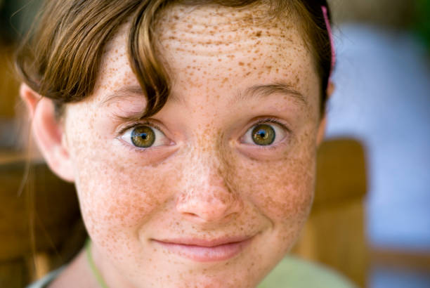 istock Cute Girl...with Freckles! 172346390