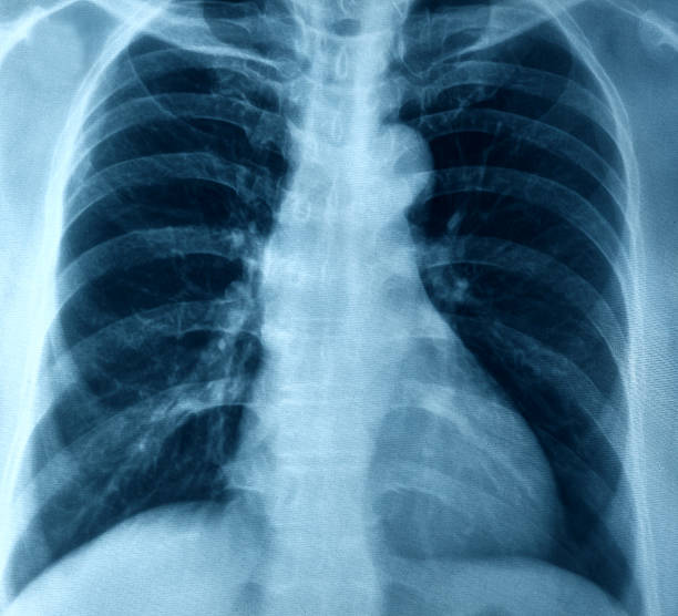 胸 x 線画像 - x ray human neck animal spine human spine ストックフォトと画像