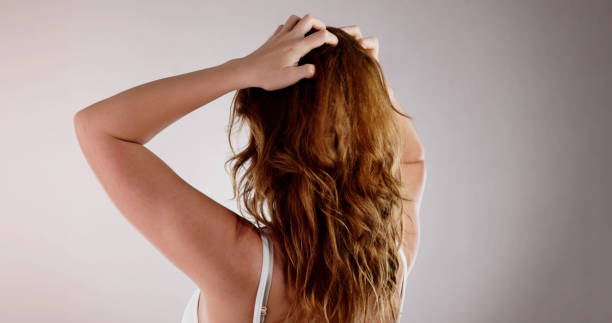 istock Itching Dry Head Scalp And Long Hair 1723588518
