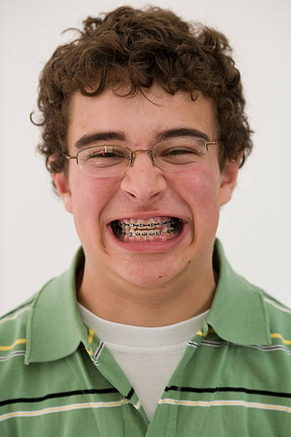 Chico adolescente con aparatos de ortodoncia - foto de stock