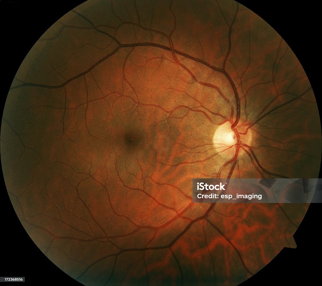 Human Retina "Retinal photograph of human eye, taken using professional clinical diagnostic equipment.Contrast and saturation enhanced compared to original capture." Retina Stock Photo