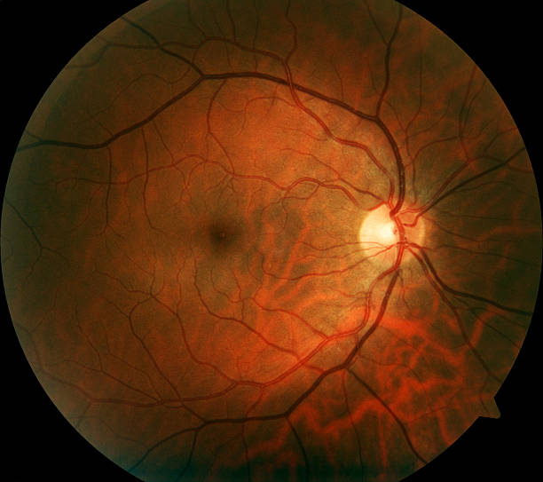 Human Retina "Retinal photograph of human eye, taken using professional clinical diagnostic equipment.Contrast and saturation enhanced compared to original capture." optometry photos stock pictures, royalty-free photos & images