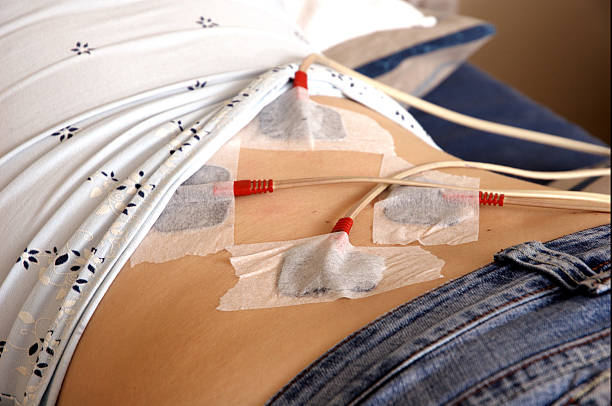 Chiropractor uses TENS electrical stimulation on woman patient stock photo