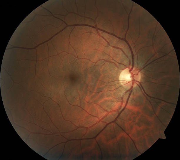 istock Retinal photograph of human eye 172391809