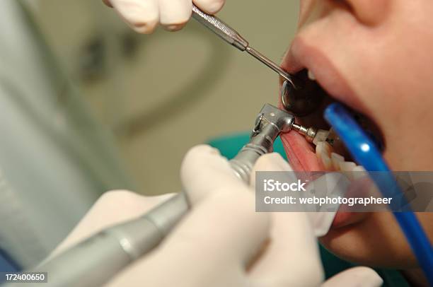 Dentysta - zdjęcia stockowe i więcej obrazów Badanie lekarskie - Badanie lekarskie, Dentysta, Dorosły