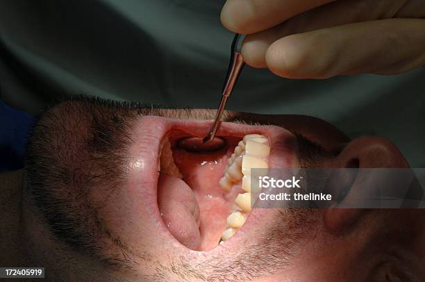 Visita Al Dentista Foto de stock y más banco de imágenes de Hombres - Hombres, Tirar de, Abierto