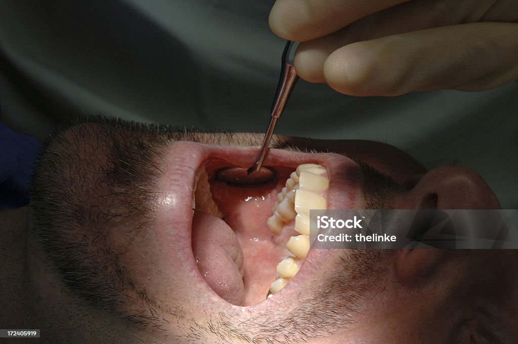 Visita dal dentista - Foto stock royalty-free di Tirare