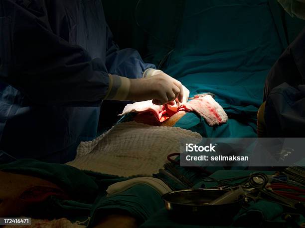 Zbliżenie Sercu - zdjęcia stockowe i więcej obrazów Aorta - Aorta, Chirurg, Chirurgia serca