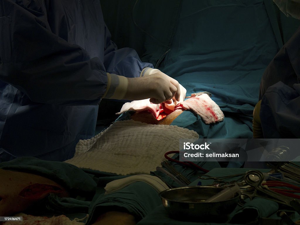 Крупный план Кардиохирур�гия - Стоковые фото Аорта роялти-фри