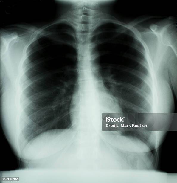 Radiografia Do Tórax - Fotografias de stock e mais imagens de Anatomia - Anatomia, Coluna vertebral humana, Coração Humano
