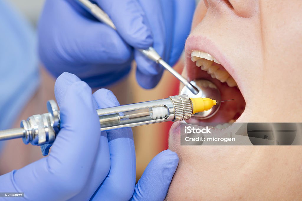 Dental anestesia - Foto stock royalty-free di Adulto