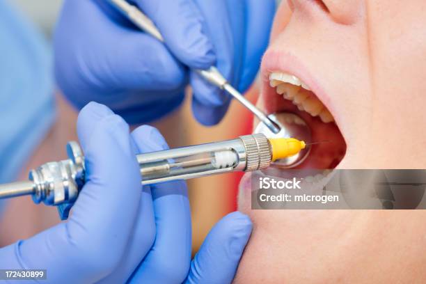 치아용 Anaesthesia 건강관리와 의술에 대한 스톡 사진 및 기타 이미지 - 건강관리와 의술, 마취 의사, 마취제