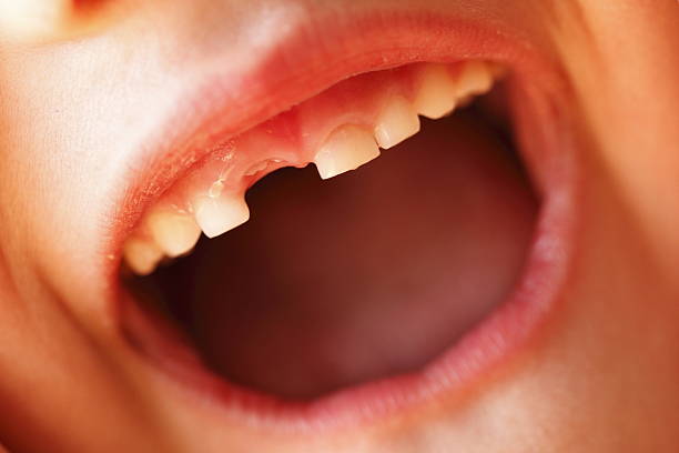 Missing Front Me 420+ Front Craig Stock Photos, Pictures & Royalty-Free Images - iStock
