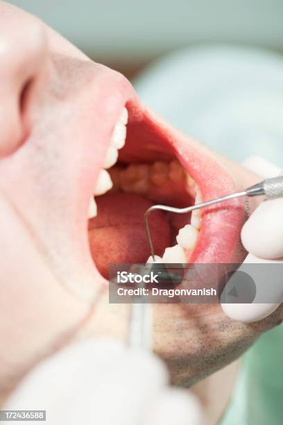 No Dentista - Fotografias de stock e mais imagens de Adulto - Adulto, Aplicar Sanguessuga, Avental