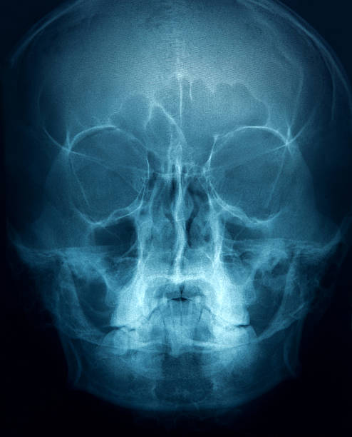 head x 線画像 - x ray human neck animal spine human spine ストックフォトと画像