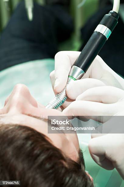 No Dentista - Fotografias de stock e mais imagens de Adulto - Adulto, Boca Humana, Ciência e Tecnologia