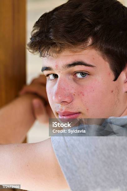 Acné Foto de stock y más banco de imágenes de Acné - Acné, Adolescente, Perfil - Vista de costado