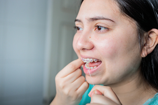 Diligent Dental Care Routine: Young Girl with Braces Demonstrating Precise Oral Hygiene by Using Dental Floss to Clean Her Teeth in the Bathroom. Close up and side view