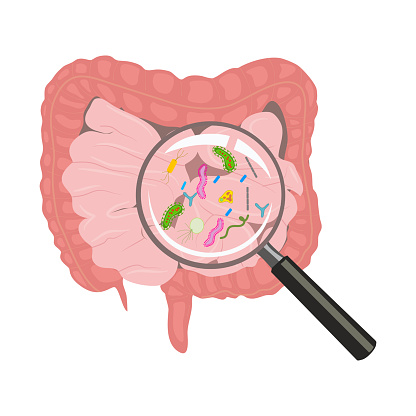 Small intestinal bacterial overgrowth (SIBO) is defined as the presence of excessive bacteria in the small intestine. SIBO is frequently implicated as the cause of chronic diarrhea and malabsorption.