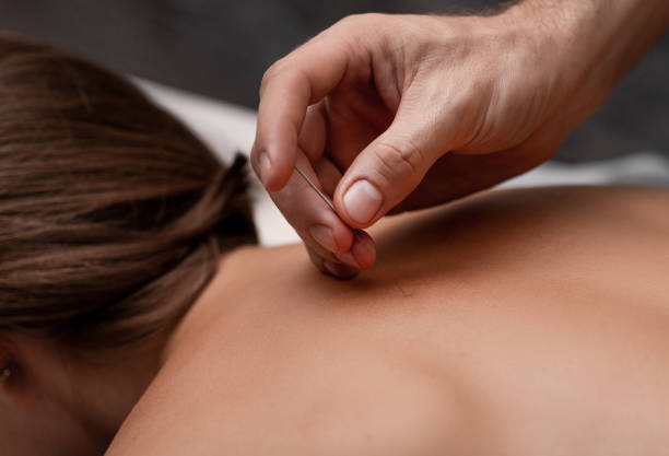 Acupuntura en Medellín: Alivio Natural y Bienestar Integral 2 Ambiente tranquilo para la acupuntura