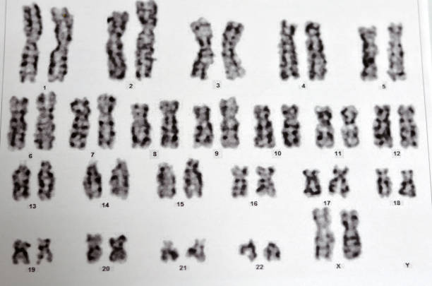 istock Normal female karyotyping, 46 XX, specimen collected from peripheral blood, a karyotype is the general appearance of the complete set of chromosomes in the cells of a species or in an individual organ 1725630987