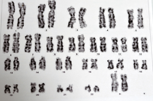 Normal female karyotyping, 46 XX, specimen collected from peripheral blood, a karyotype is the general appearance of the complete set of chromosomes in the cells of a species or in an individual organ, selective focus