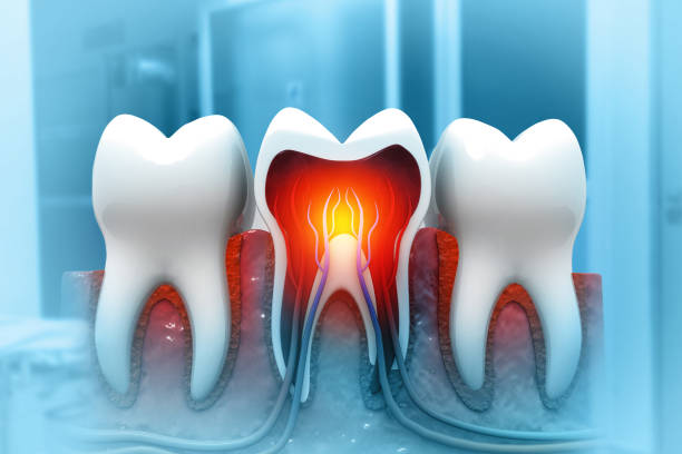 istock Human tooth structure. cross section. pulp with blood vessels and nerves. 3d illustration 1725826437