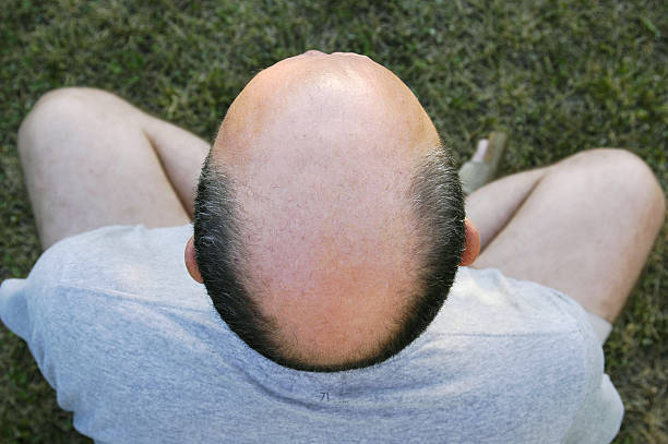 parcialmente calvo hombre - completely bald fotografías e imágenes de stock