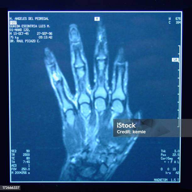 Radiografie A Mano - Fotografie stock e altre immagini di Immagine a raggi X - Immagine a raggi X, Visore - Attrezzatura fotografica, Analizzare