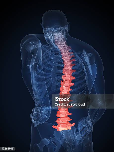 휴머니즘 척추 일러스트 X-레이에 대한 스톡 사진 및 기타 이미지 - X-레이, 건강관리와 의술, 등