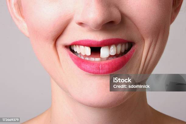 トゥースありません - すきっ歯のストックフォトや画像を多数ご用意 - すきっ歯, 女性, 笑顔