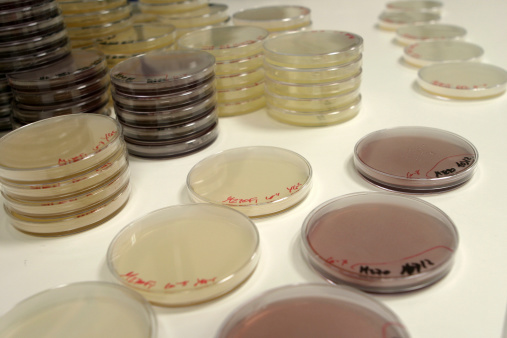 Petri plates in a laboratory.