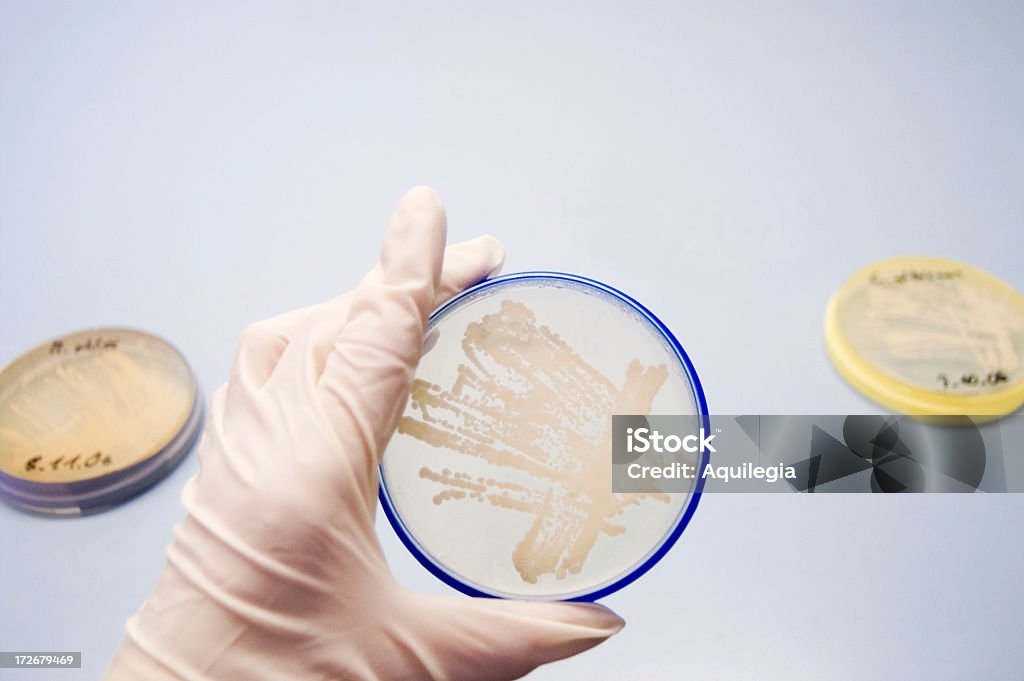 Placa de Agar con cultivado microorganismos de bacterias - Foto de stock de Agar-agar libre de derechos