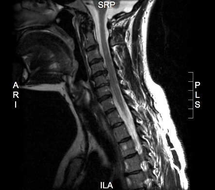 MRI of the cervical spine.  To see more medical related images: 