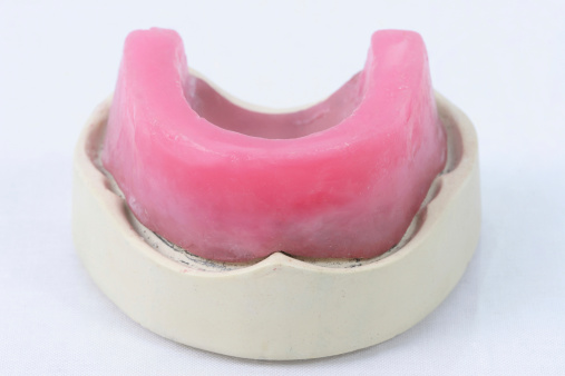 Denture preparation with Dental plaster mould and wax denture.