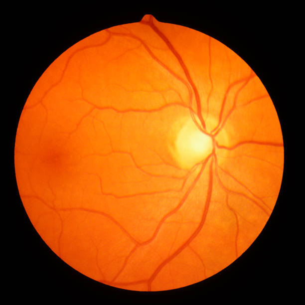 human optic disc, retina and blood vessels fundusphoto made with a special retina camera retina stock pictures, royalty-free photos & images