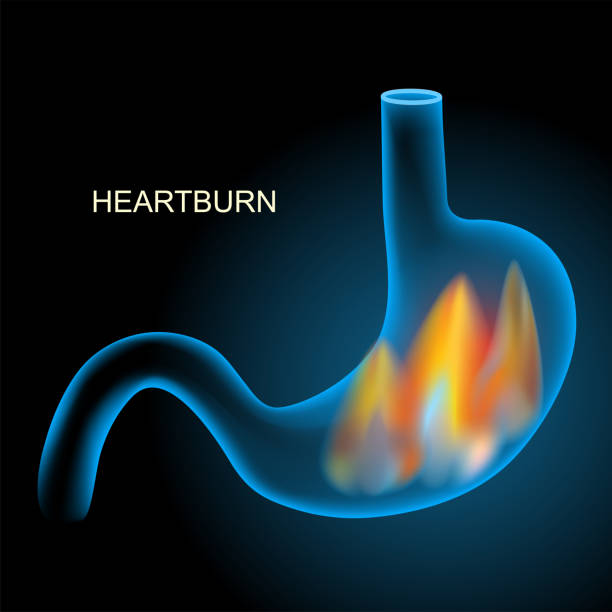 Pyrosis Cartoon 520+ Stomach Fire Stock Illustrations, Royalty-Free Vector Graphics ...