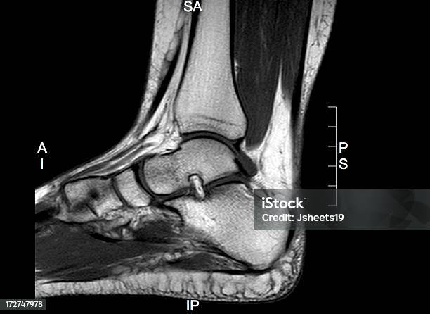 Knöchel Mri Stockfoto und mehr Bilder von Magnetresonanztomographie - Magnetresonanztomographie, Magnetresonanztomograph, Knöchel